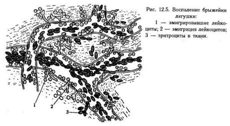 Реферат: воспаление 2