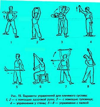 Физическая реабилитация при переломах плечевой кости