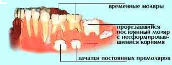 Лечение зубов у детей реферат